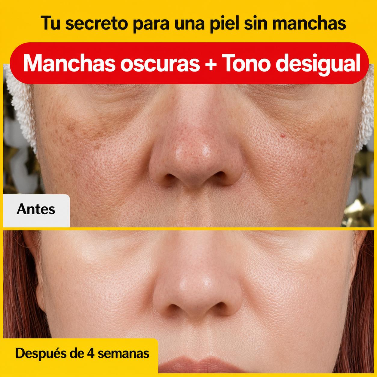Sérum Antimanchas con Vitamina C | Piel Más Luminosa y Uniforme